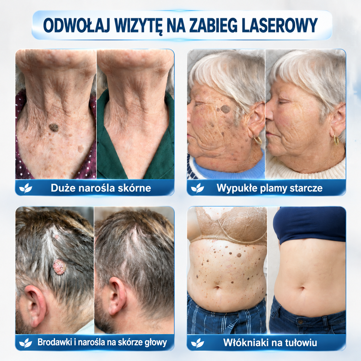 ⭐🐬𝑶𝒇𝒊𝒄𝒋𝒂𝒍𝒏𝒚 𝑺𝒌𝒍𝒆𝒑 | 𝐕𝐄𝐋𝐍𝐎𝐑𝐀® 𝒁𝒊𝒐ł𝒐𝒘𝒚 𝑷𝒍𝒂𝒔𝒕𝒆𝒓 𝑯𝒚𝒅𝒓𝒐ż𝒆𝒍𝒐𝒘𝒚 𝒁 𝑴𝒊𝒌𝒓𝒐𝒊𝒈ł𝒂𝒎𝒊 (𝒏𝒂 𝒘łó𝒌𝒏𝒊𝒂𝒌𝒊, 𝒎𝒂ł𝒆 𝒏𝒂𝒓𝒐ś𝒍𝒂 𝒔𝒌ó𝒓𝒏𝒆, 𝒃𝒓𝒐𝒅𝒂𝒘𝒌𝒊, 𝒑𝒊𝒆𝒑𝒓𝒛𝒚𝒌𝒊, 𝒑𝒍𝒂𝒎𝒚 𝒔𝒕𝒂𝒓𝒄𝒛𝒆 𝒊 𝒑𝒓𝒐𝒃𝒍𝒆𝒎𝒚 𝒛 𝒑𝒓𝒛𝒆𝒃𝒂𝒓𝒘𝒊𝒆𝒏𝒊𝒂𝒎𝒊)